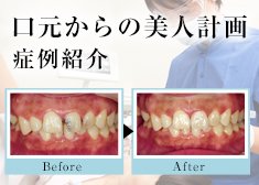 口元からの美人計画症例紹介